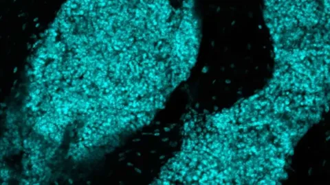 Estruturas imunes inéditas no crânio podem virar arma contra câncer cerebral, aponta estudo publicado na Nature